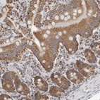 Anti-PLD5 Antibody