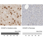 Anti-CCSAP Antibody