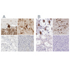 Anti-CCSAP Antibody