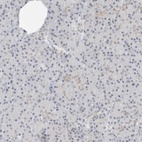 Anti-CCSAP Antibody