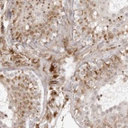 Anti-TCTEX1D1 Antibody