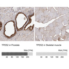 Anti-TPD52 Antibody