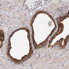 Anti-TPD52 Antibody