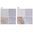 Anti-LMOD1 Antibody