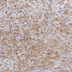 Anti-LMOD1 Antibody