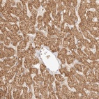 Anti-RSG1 Antibody