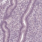 Anti-FAM71A Antibody