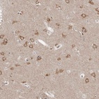 Anti-NENF Antibody