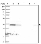 Lane 1: Marker [kDa] 230, 130, 95, 72, 56, 36, 28, 17, 11_br/_Lane 2: Human cell line RT-4_br/_Lane 3: Human cell line U-251MG sp_br/_Lane 4: Human plasma (IgG/HSA depleted)_br/_Lane 5: Human liver tissue_br/_Lane 6: Human tonsil tissue