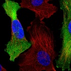 Anti-C1orf74 Antibody