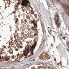 Anti-NUP43 Antibody