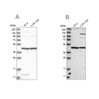 Anti-NUP43 Antibody