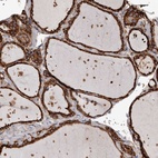 Anti-OSGIN2 Antibody