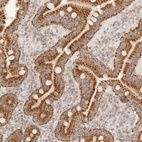 Anti-COA6 Antibody