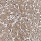 Anti-GCH1 Antibody