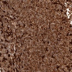 Anti-GBP5 Antibody