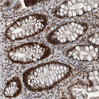 Anti-CHD1L Antibody