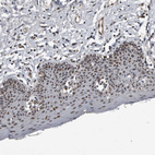 Anti-CHD1L Antibody