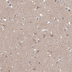 Anti-PFDN2 Antibody