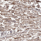 Anti-PFDN2 Antibody