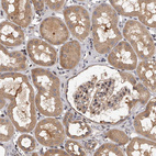 Anti-PFDN2 Antibody