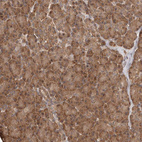 Anti-RWDD1 Antibody