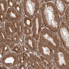 Anti-RWDD1 Antibody