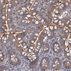 Anti-INPP5B Antibody