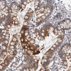 Anti-MOGAT2 Antibody