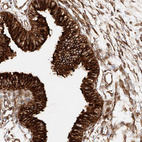 Immunohistochemical staining of human fallopian tube shows very strong cytoplasmic positivity in glandular cells.