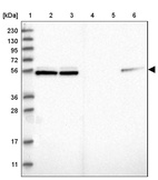 Lane 1: Marker [kDa] 230, 130, 95, 72, 56, 36, 28, 17, 11_br/_Lane 2: Human cell line RT-4_br/_Lane 3: Human cell line U-251MG sp_br/_Lane 4: Human plasma (IgG/HSA depleted)_br/_Lane 5: Human liver tissue_br/_Lane 6: Human tonsil tissue