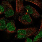 Anti-PKNOX2 Antibody