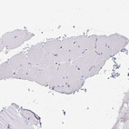 Immunohistochemical staining of human skeletal muscle shows no positivity in myocytes as expected.