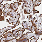 Immunohistochemical staining of human placenta shows strong membranous and cytoplasmic positivity in trophoblastic cells.