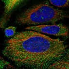 Immunofluorescent staining of human cell line HeLa shows localization to nucleoli fibrillar center, plasma membrane & vesicles.