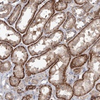 Anti-AKAP10 Antibody