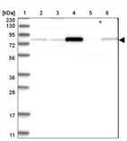 Anti-AKAP10 Antibody