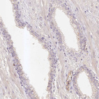 Anti-ELL3 Antibody