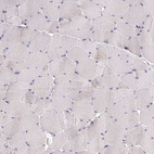 Anti-ELL3 Antibody