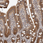 Anti-GLRX3 Antibody