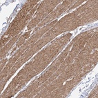 Anti-ZNF180 Antibody