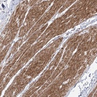 Anti-ZNF180 Antibody