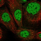 Anti-ZNF180 Antibody