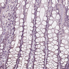 Anti-EGR4 Antibody