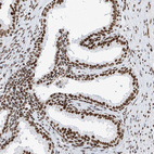 Anti-SRSF6 Antibody