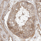 Anti-CSMD3 Antibody