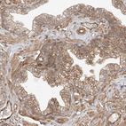 Anti-CSMD3 Antibody