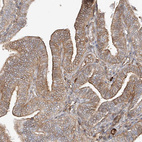 Anti-CSMD3 Antibody