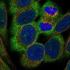 Anti-CSMD3 Antibody