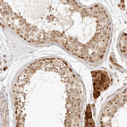 Anti-INTS11 Antibody